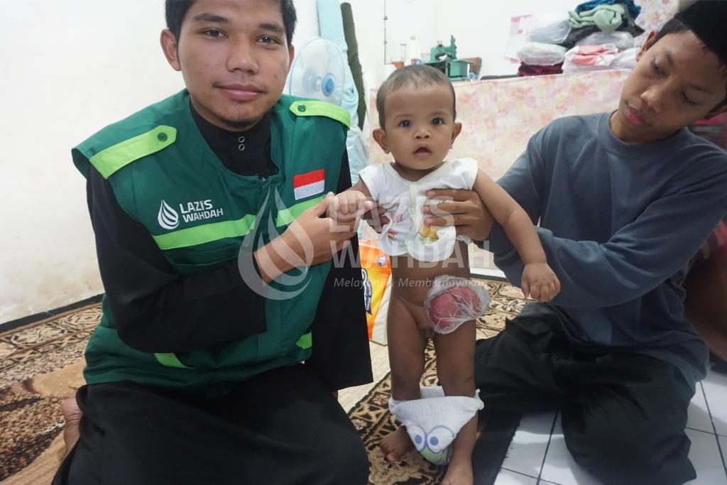 LAZIS Wahdah Bantu Biaya Operasi Bayi Said